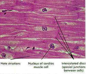 Cardiac muscle picture